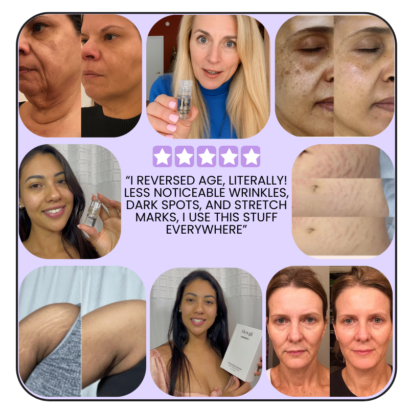 Extra Strength- Anti-Aging Micro Infusion Kit